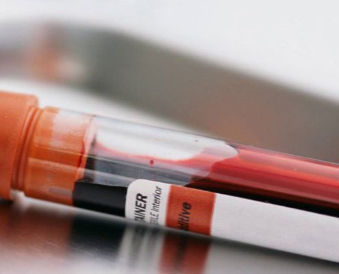 آزمایش خون به بررسی پروفایل خونی یک فرد گفته می‌شود.