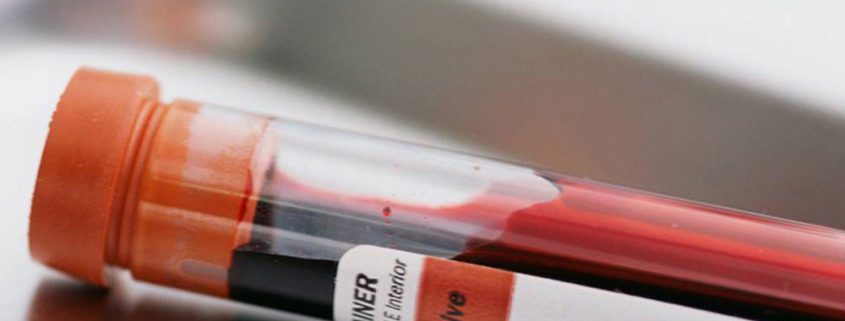 آزمایش خون به بررسی پروفایل خونی یک فرد گفته می‌شود.