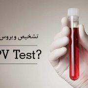 تشخیص ویروس HPV